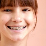 ortodontia-crianca-aparelho